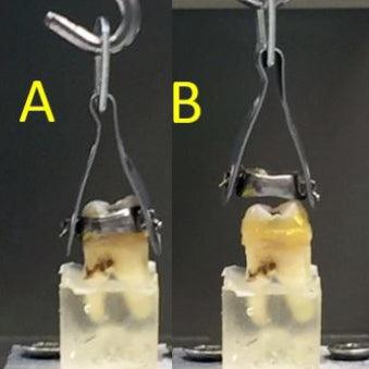 FIRST-EVER REVERSIBLE CEMENT - amdlasers